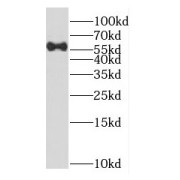 WB analysis of K-562 cells, using DYNC1LI1 antibody (1/1000 dilution).
