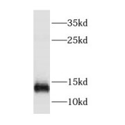 WB analysis of human brain tissue, using DYNLT3 antibody (1/500 dilution).
