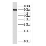 WB analysis of Jurkat cells, using E2A antibody (1/500 dilution).