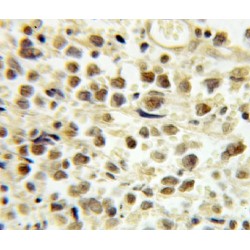 Transcription Factor E2F4 (E2F4) Antibody