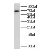 WB analysis of COLO 320 cells, using EBF3 antibody (1/500 dilution).