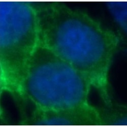 E-cadherin Antibody