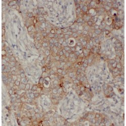 E-cadherin Antibody