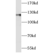WB analysis of mouse testis tissue, using E-cadherin antibody (1/2000 dilution).