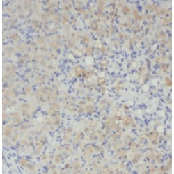 Extracellular Matrix Protein 2 (ECM2) Antibody