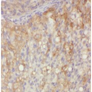 IHC-P analysis of human ovary tissue, using ECOP Antibody (1/50 dilution).