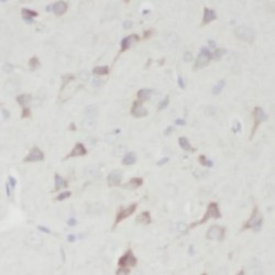 Lysophosphatidic Acid Receptor Edg-2 (EDG2) Antibody