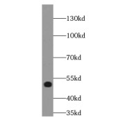 WB analysis of PC-3 cells, using LPAR3-Specific antibody (1/500 dilution).