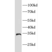 WB analysis of SKOV-3 cells, using EEF1B2 antibody (1/1000 dilution).