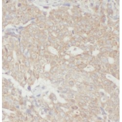 Eukaryotic Translation Elongation Factor 1 Epsilon 1 (EEF1E1) Antibody