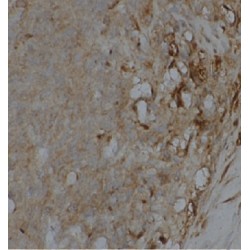 Eukaryotic Translation Elongation Factor 2 (EEF2) Antibody