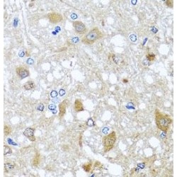Myoclonin 1 (EFHC1) Antibody