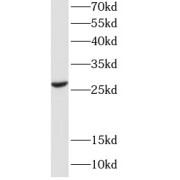 WB analysis of mouse lung tissue, using EFHD2 antibody (1/1000 dilution).
