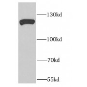 WB analysis of mouse testis tissue, using EFTUD2 antibody (1/1000 dilution).