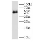 WB analysis of mouse brain tissue, using EGR2 antibody (1/1000 dilution).