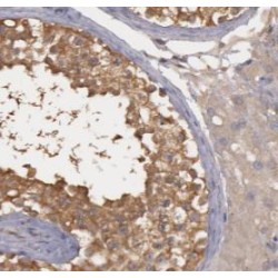 EH Domain-Binding Protein 1 (EHBP1) Antibody