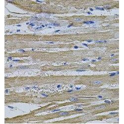 Eukaryotic Translation Initiation Factor 1A, Y-Chromosomal (EIF1AY) Antibody