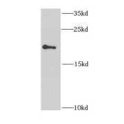 WB analysis of MCF7 cells, using EIF1AY antibody (1/1000 dilution).