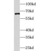 WB analysis of HepG2 cells, using EIF2A antibody (1/300 dilution).