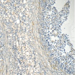 Eukaryotic Translation Initiation Factor 2B Subunit Beta (EIF2B2) Antibody