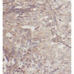 Eukaryotic Translation Initiation Factor 2B Subunit Delta (EIF2B4) Antibody