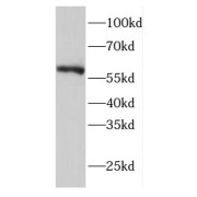 WB analysis of human skeletal muscle tissue, using EIF2B4 antibody (1/400 dilution).