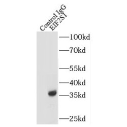 Eukaryotic Translation Initiation Factor 2 Subunit 1 (EIF2S1) Antibody