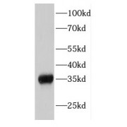 WB analysis of human stomach tissue, using EIF2S1 antibody (1/500 dilution).