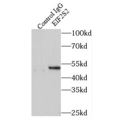 Eukaryotic Translation Initiation Factor 2 Subunit 2 (EIF2S2) Antibody