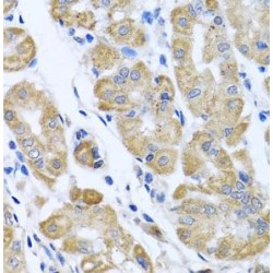 Eukaryotic Translation Initiation Factor 2 Subunit 3 (EIF2S3) Antibody