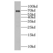 WB analysis of mouse brain tissue, using EIF3L antibody (1/300 dilution).