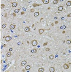 Eukaryotic Initiation Factor 4A-II (EIF4A2) Antibody