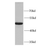 WB analysis of Jurkat cells, using EIF4A2 antibody (1/1000 dilution).