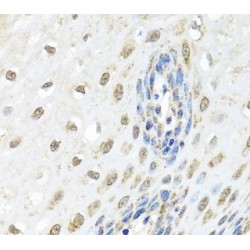 Zinc Phosphodiesterase ELAC Protein 2 (ELAC2) Antibody