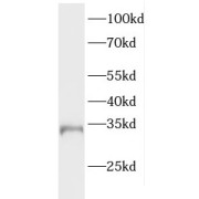 WB analysis of A549 cells, using ELMOD2 antibody (1/400 dilution).