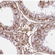 IHC-P analysis of human testis tissue, using ELOVL2 antibody (1/50 dilution).