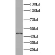 WB analysis of Raji cells, using ELOVL6 antibody (1/800 dilution).