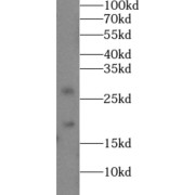 WB analysis of human liver tissue, using Endostatin, COL18A1 antibody (1/500 dilution).