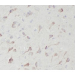 Alpha-Enolase (ENO1) Antibody