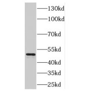 WB analysis of human skeletal muscle tissue, using ENO3 antibody (1/500 dilution).