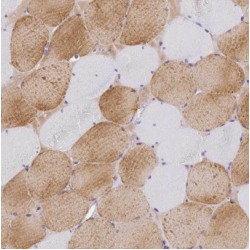 Beta-Enolase (ENO3) Antibody