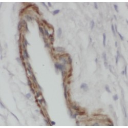 Equilibrative Nucleoside Transporter 1 (ENT1) Antibody