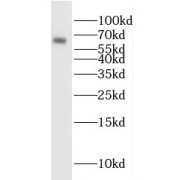 WB analysis of mouse brain tissue, using ENT1 antibody (1/500 dilution).