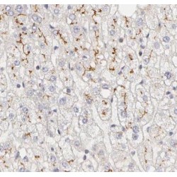 Ectonucleoside Triphosphate Diphosphohydrolase 1 (ENTPD1) Antibody