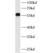 abx232781