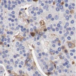 Ectonucleoside Triphosphate Diphosphohydrolase 6 (ENTPD6) Antibody