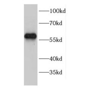 WB analysis of mouse spleen tissue, using ENTPD6 antibody (1/600 dilution).