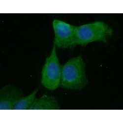 Epithelial Cell Adhesion Molecule (EPCAM) Antibody