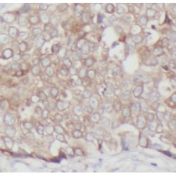 Epithelial Cell Adhesion Molecule (EPCAM) Antibody