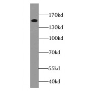 WB analysis of A549 cells, using EPHA1-special antibody (1/800 dilution).
